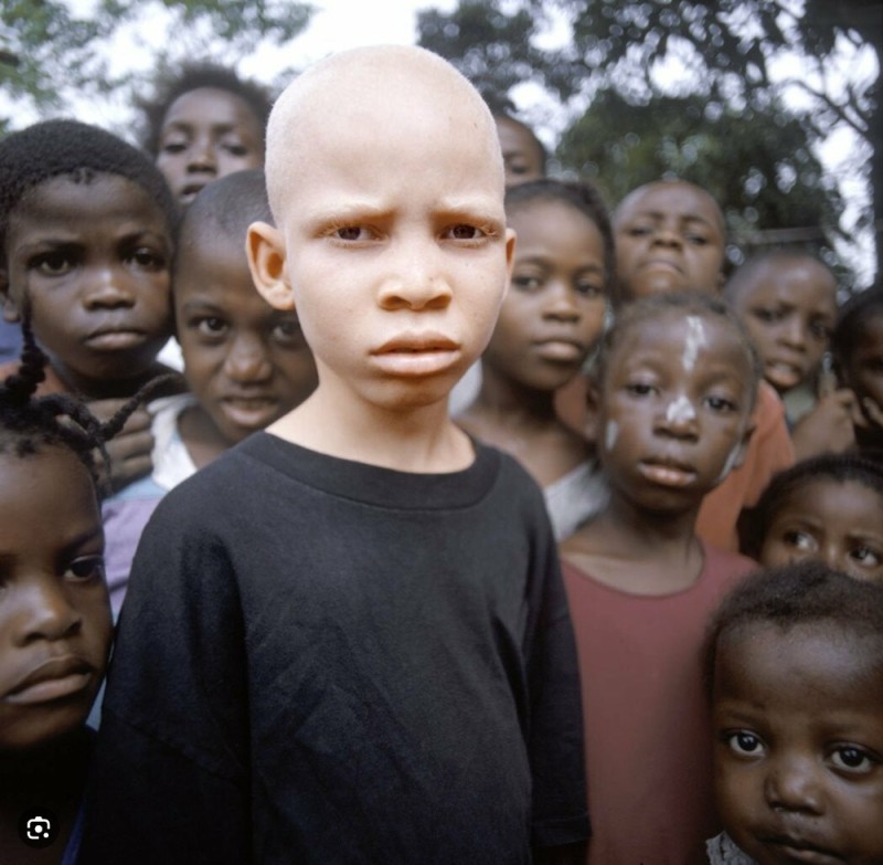 Create meme: Negro albino, albinos in Africa, the negro is white