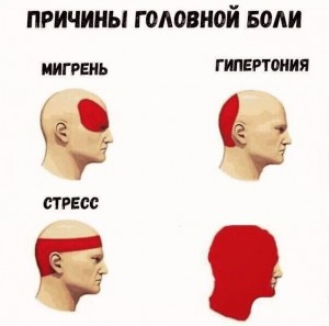 Создать мем: разновидности головной боли, болит затылок, типы головной боли