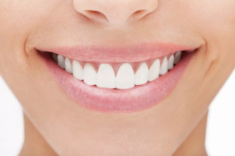 Создать мем: красивые ровные зубы, идеальные зубы, красивая улыбка зубы
