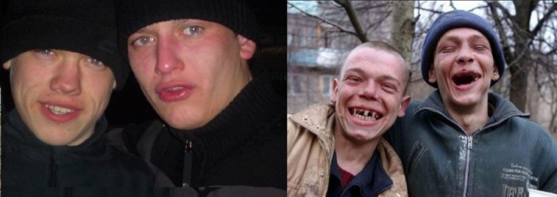 Create meme: a homeless person with no teeth, toothless bum, the face of an alcoholic without teeth