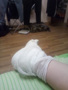 Create meme: broken arm, cat, a broken leg in a cast boy