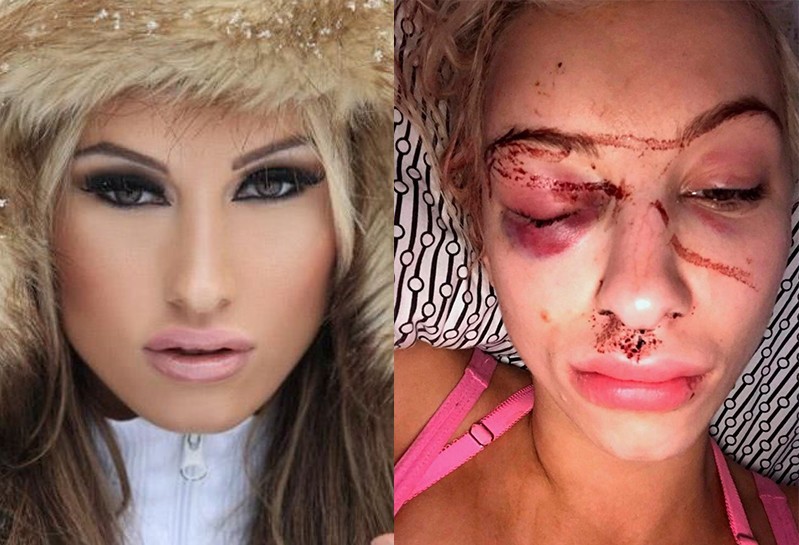 Create meme: beaten blonde, lover, battered woman