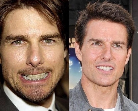Create meme: Tom cruise , Tom Cruise teeth, Tom Cruise with crooked teeth