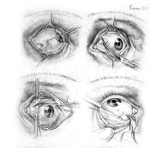 Создать мем: глаз рисунок анатомия, конъюнктивальный мешок глаза, эвисцерация глаза