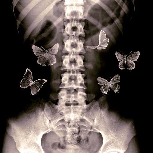 Создать мем: бабочки в животе фон, иллюстрация, рентген бабочки