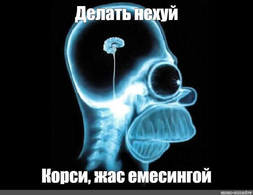 x-ray of brain Simpson,x-ray of Homer's brain,brain Homer Simpson...