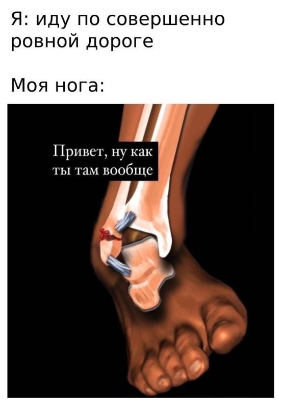 Create meme: fracture of the ankle joint, rupture of leg ligaments, closed ankle fracture