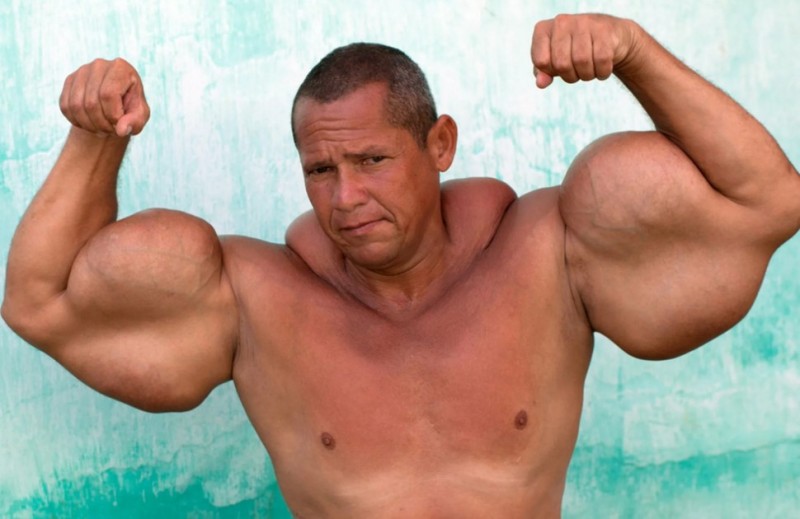 Create meme: arlindo de Souza, big biceps, the largest bicep in the world