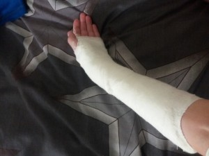 Create meme: a broken leg, a broken leg, finger fracture plaster