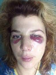 Create meme: woman, battered woman