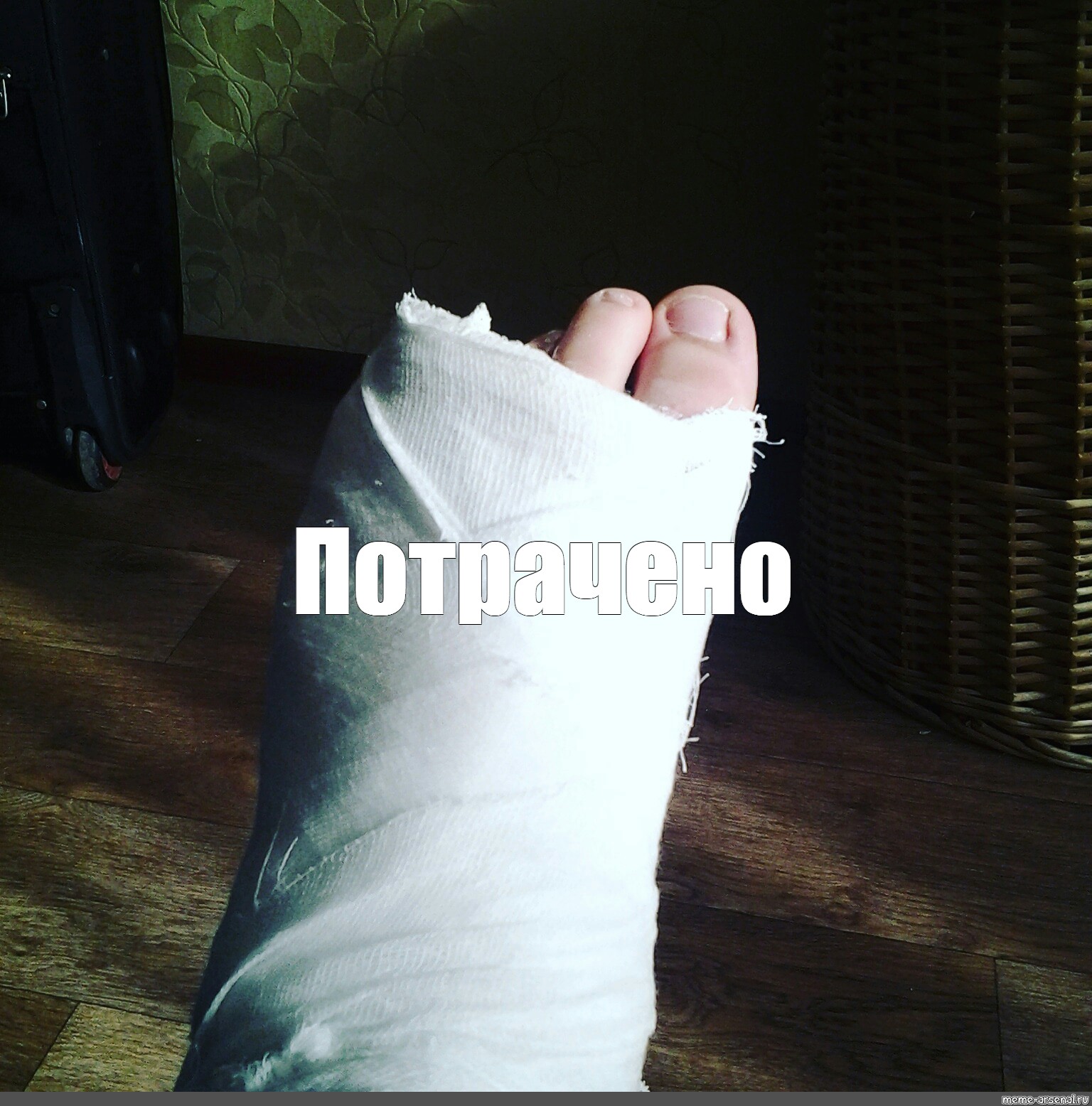 Мем: "Потрачено", , broken ankle,гипс,ноги.