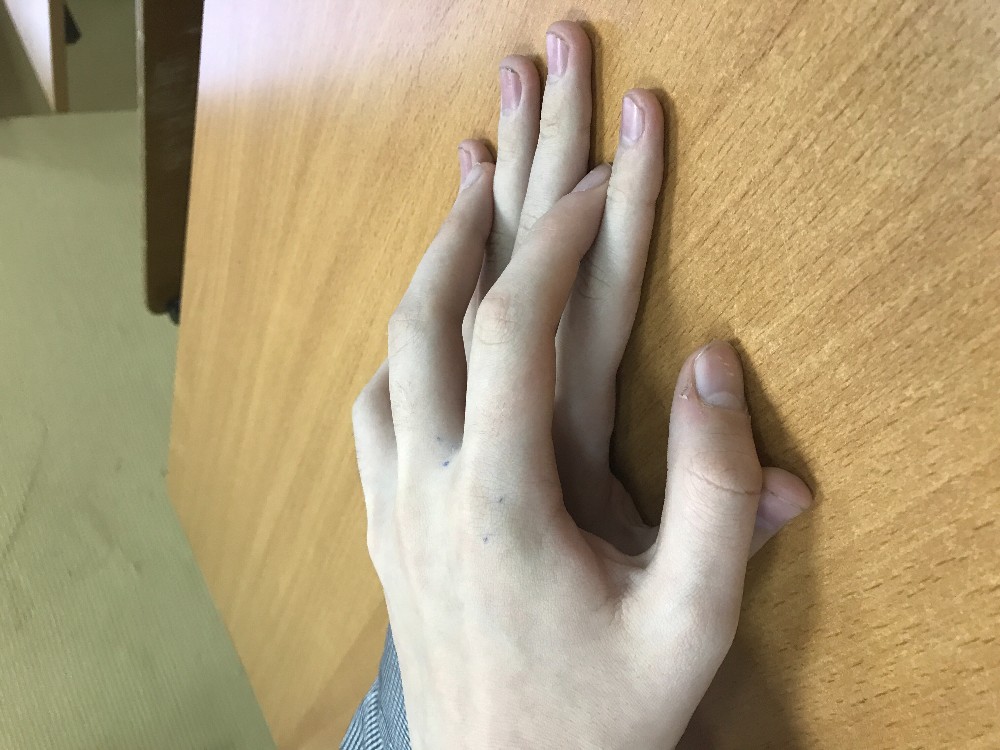 Long Toes Meme