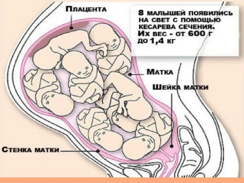 Create meme: location of organs during pregnancy, placenta weight, placentation during pregnancy