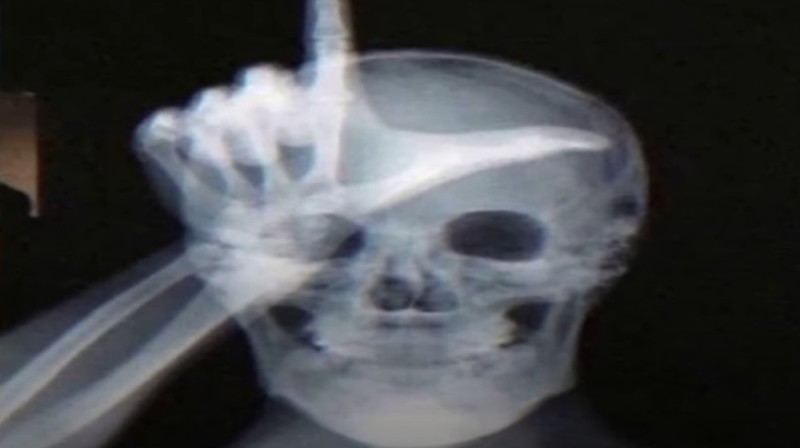 Create meme: x-ray, skeleton , a head x-ray
