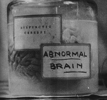 Create meme: Waldman Frankenstein 1931, abnormal, The brain is in a jar