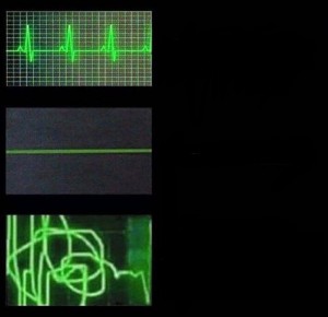 Создать мем: пульс когда волнуешься, heartbeat, heartbeat meme