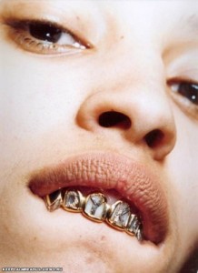 Создать мем: брекеты, зубы, grillz