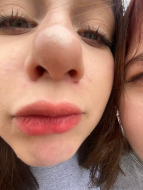 Create meme: lips lips, lower lips, enlarged lips