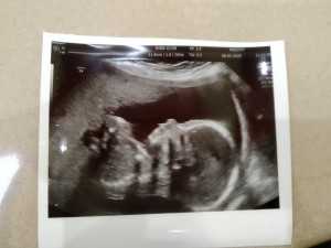 Create meme: ultrasound 18.5 weeks, ultrasound in pregnancy, ultrasound 14 weeks pregnant boy