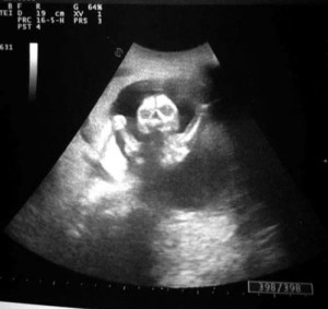 Create meme: pregnancy ultrasound