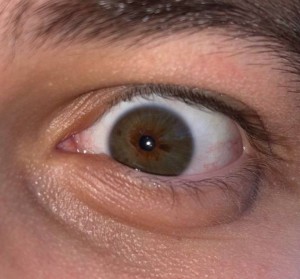 Создать мем: гетерохромия глаз у людей, гемофтальм глаза, цвет глаз