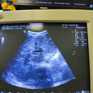 Create meme: ultrasound of the kidneys, ultrasound