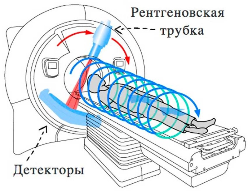 Create meme: x-ray tube of the tomograph, spiral computed tomography, multispiral computed tomography scheme
