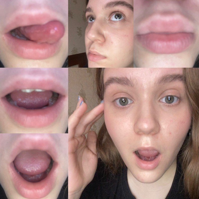 Create meme: made lips, lips after enlargement, natural lips