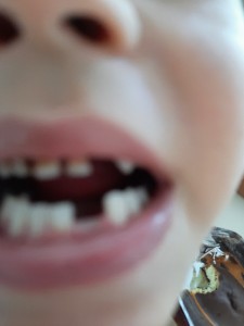 Create meme: milk teeth, teeth in children, teeth