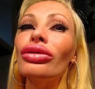 Create meme: Victoria Wilde big lips, silicone lips , botoxed lips