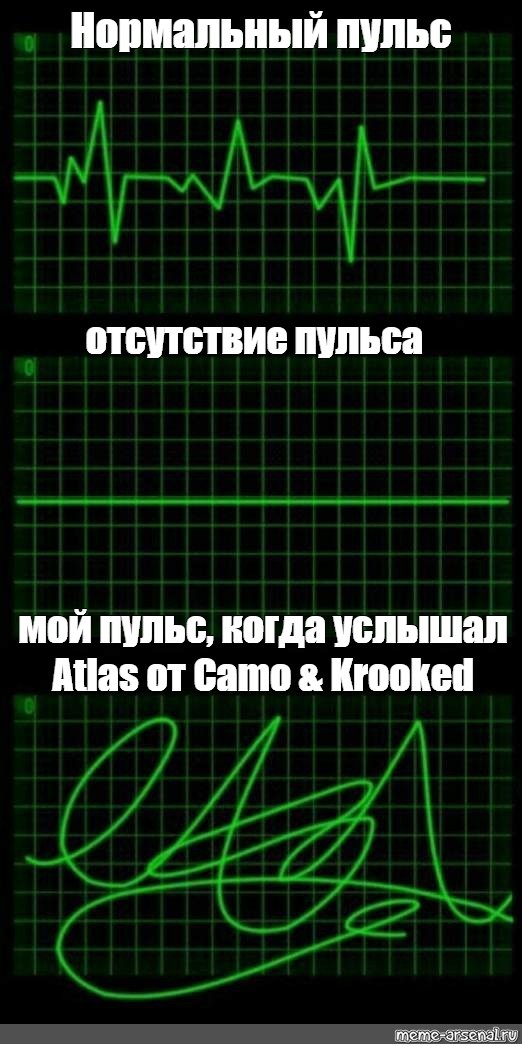 Песня убери руки с моего пульса текст. Пульс Мем. Сердцебиение Мем. Пульса нет Мем. Пульс отсутствует.