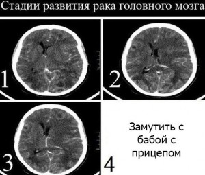 Create meme: full amaralina, the brain, stad development of the brain mozku