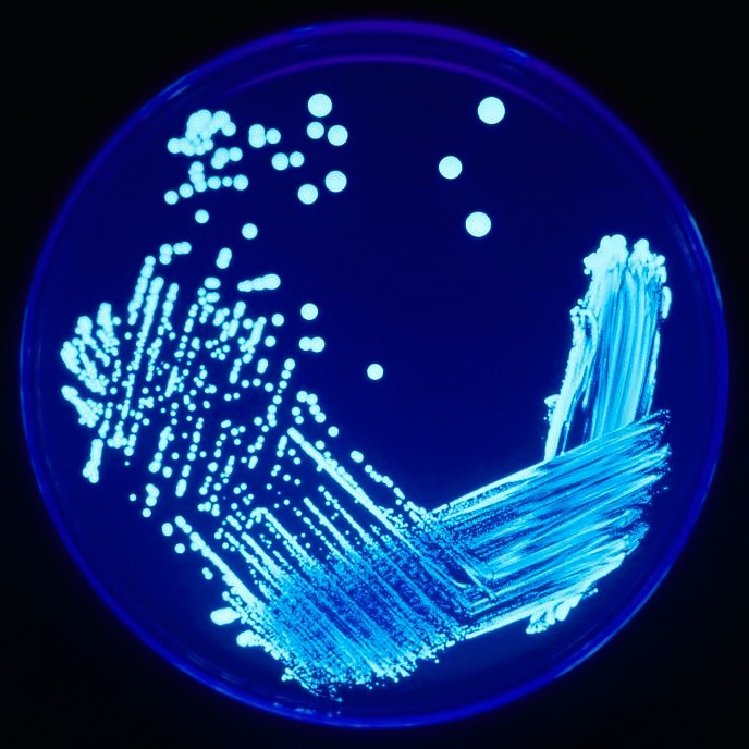 Create meme: legionellosis, Microbiology, streak plate method