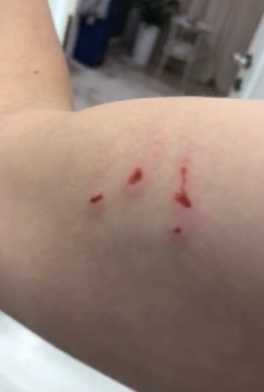 Create meme: body part, bites, scratched by a cat