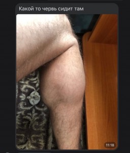 Create meme: feet, Part of the human body, swollen knee