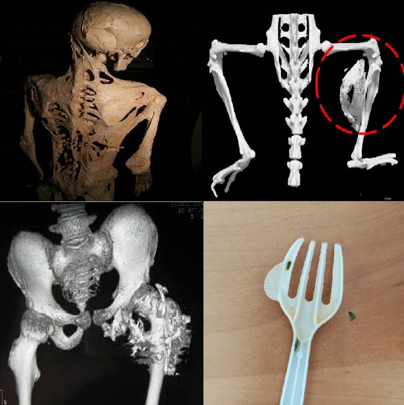Создать мем: кости скелет, человеческий скелет, скелет