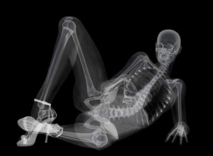 Создать мем: рентген скелет сбоку, рентген женского тела, ренген
