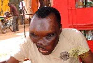 Создать мем: следы на коже, самый страшный человек на планете, роман кашигин уганда
