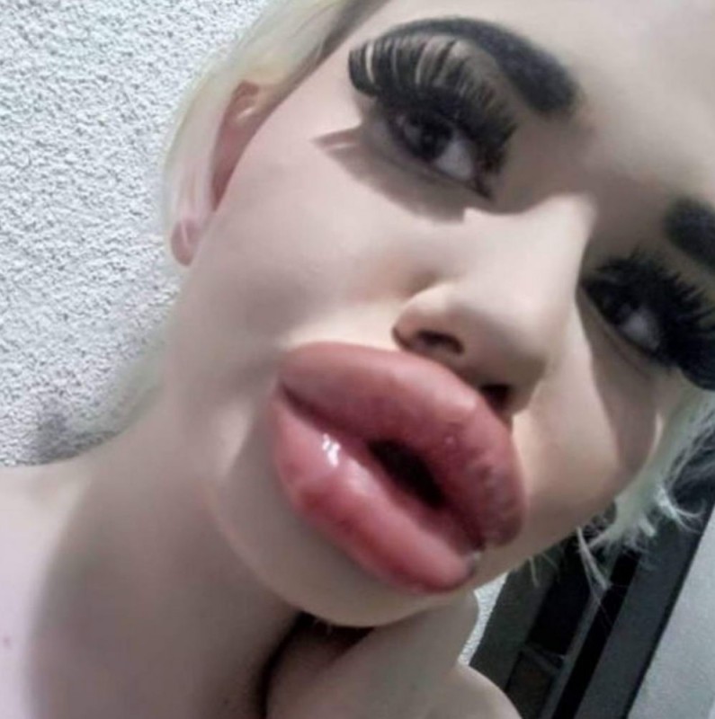 Создать мем: девушка с самыми большими губами, силиконовые губы большие, огромные силиконовые губы