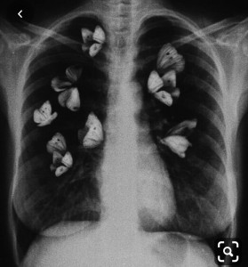 Create meme: easy, Blurred image, x-ray butterfly