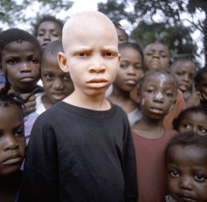 Create meme: albinos in Africa, Negros