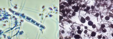 Create meme: nail fungus under the microscope, onychomycosis microscopy, lichen under the microscope